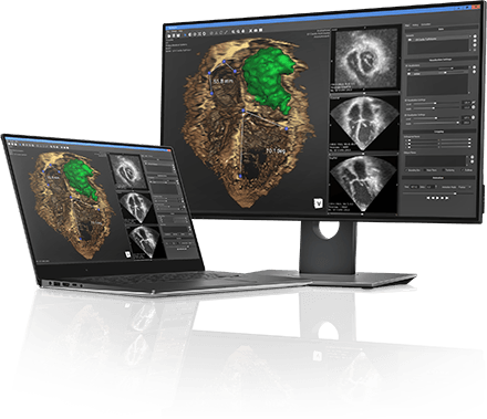 3D Medical Viewer for Windows
